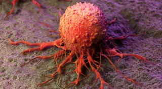 Что такое рак: Факторы риска развития раковых заболеваний