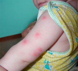 Есть ли эффективные средства защиты от комаров для малышей?