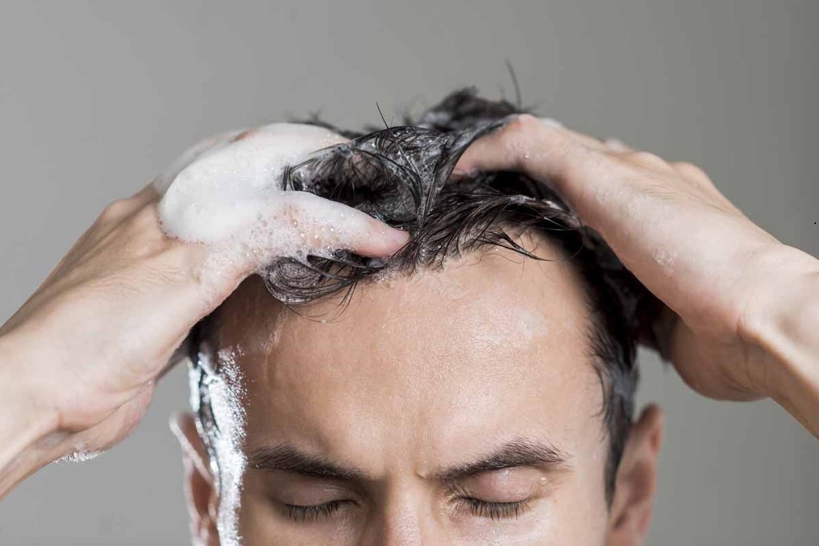 Как вылечить волосы мужчины от перхоти